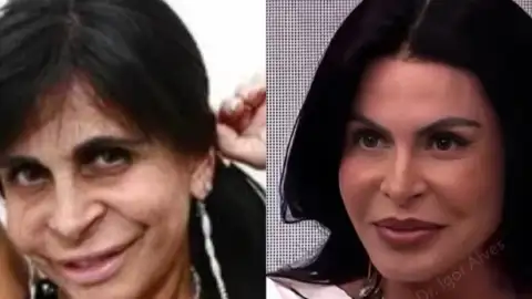 Gretchen exibe "novo rosto" e surpreende seguidores nas redes sociais