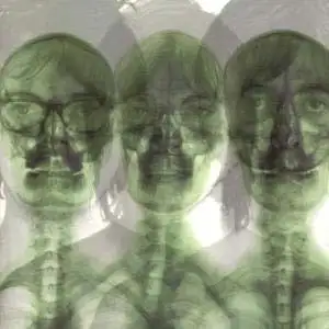 Supergrass